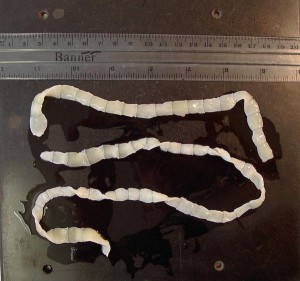 tapeworm-proglottids_l