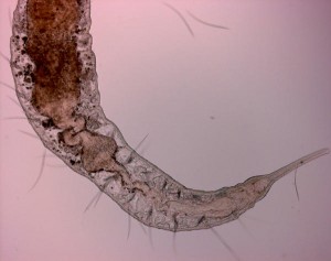 tapeworm-anyone_l